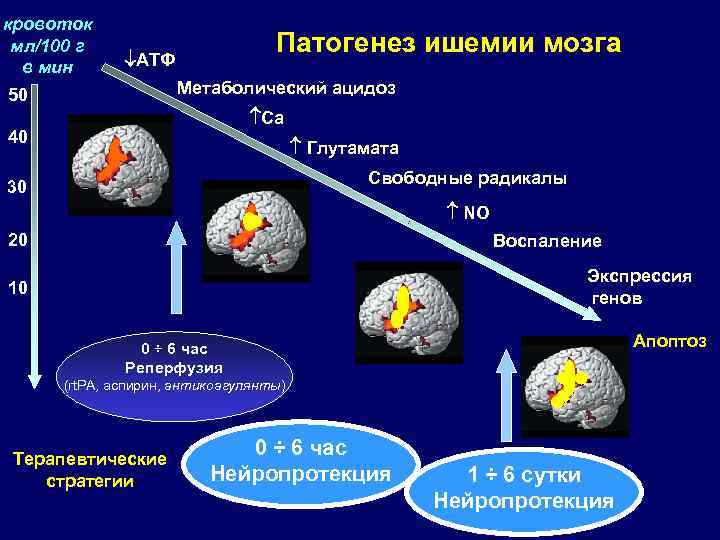 Механизмы развития ишемии. Патогенез ишемии мозга. Нейропротективная терапия. Церебральная ишемия патогенез. Патогенез хронической ишемии головного мозга.
