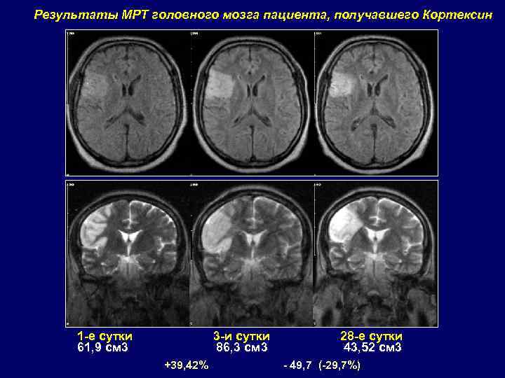 Мрт головного мозга время