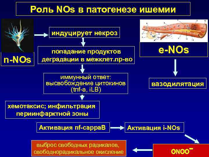 Этиология ишемии