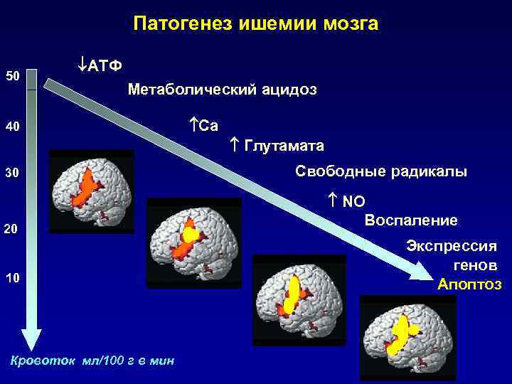 Ишемические повреждения мозга. Ишемическое повреждение мозга. Этиология хронической ишемии мозга. Патогенез ишемии. Механизм развития ишемии.