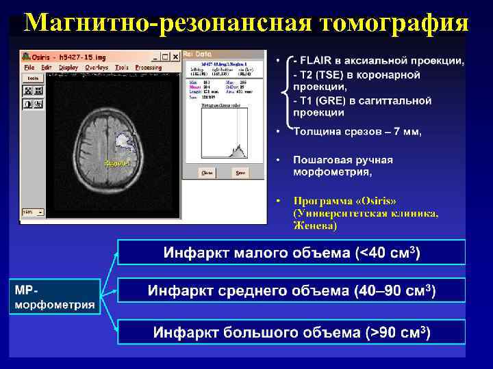 Магнитно-резонансная томография 