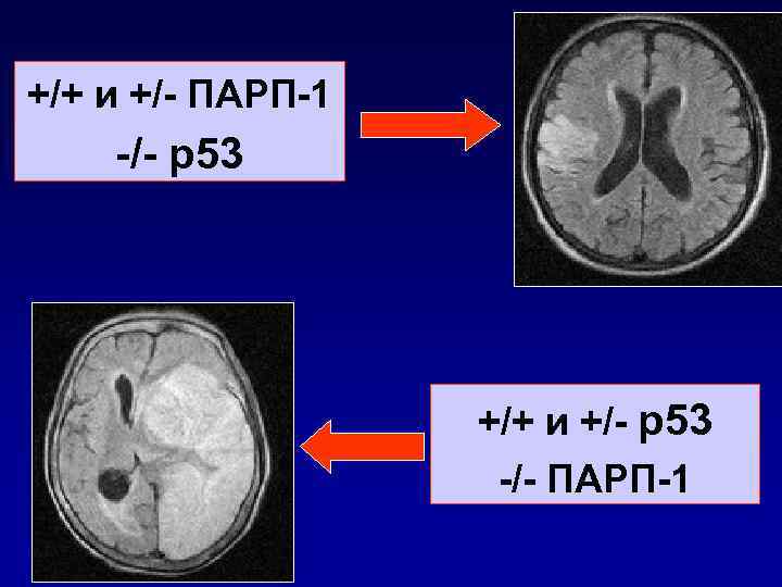 +/+ и +/- ПАРП-1 -/- р53 +/+ и +/- р53 -/- ПАРП-1 