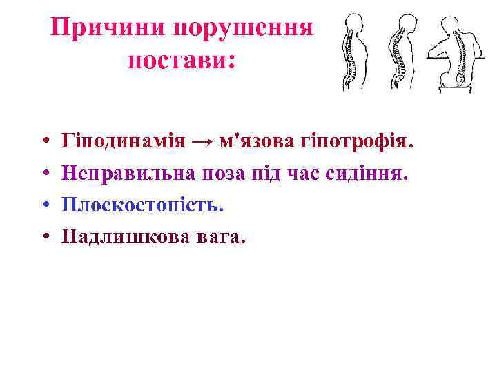 Причини порушення постави: • • Гіподинамія → м'язова гіпотрофія. Неправильна поза під час сидіння.