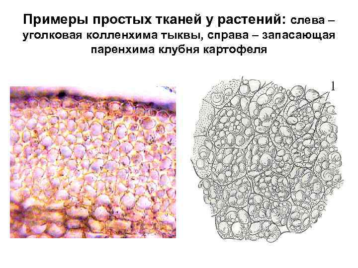 Примеры простых тканей у растений: слева – уголковая колленхима тыквы, справа – запасающая паренхима