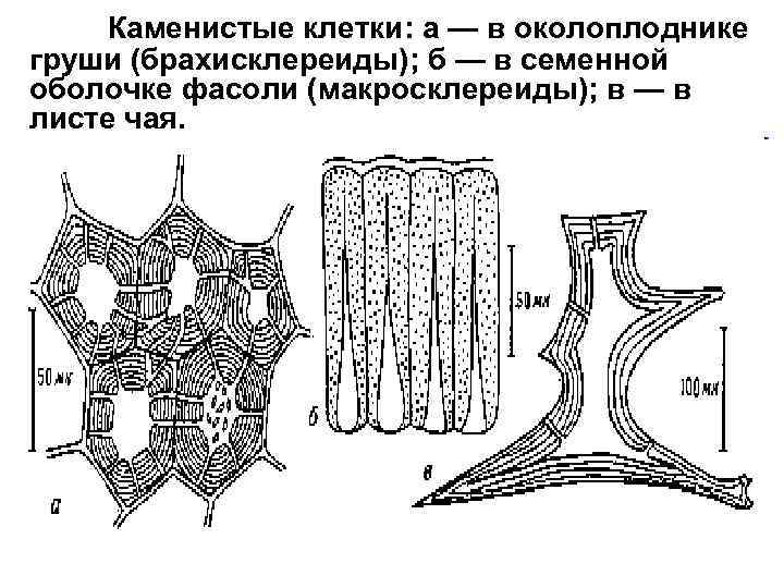 Каменистые клетки: а — в околоплоднике груши (брахисклереиды); б — в семенной оболочке фасоли