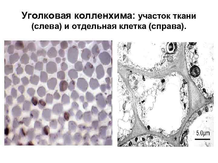 Уголковая колленхима: участок ткани (слева) и отдельная клетка (справа). 