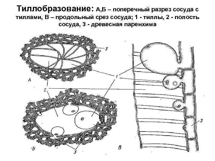 Тиллобразование: А, Б – поперечный разрез сосуда с тиллами, В – продольный срез сосуда;