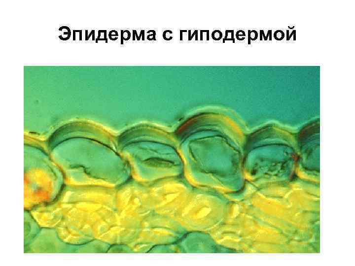 Эпидерма с гиподермой 
