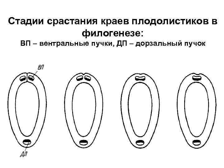 Стадии срастания краев плодолистиков в филогенезе: ВП – вентральные пучки, ДП – дорзальный пучок
