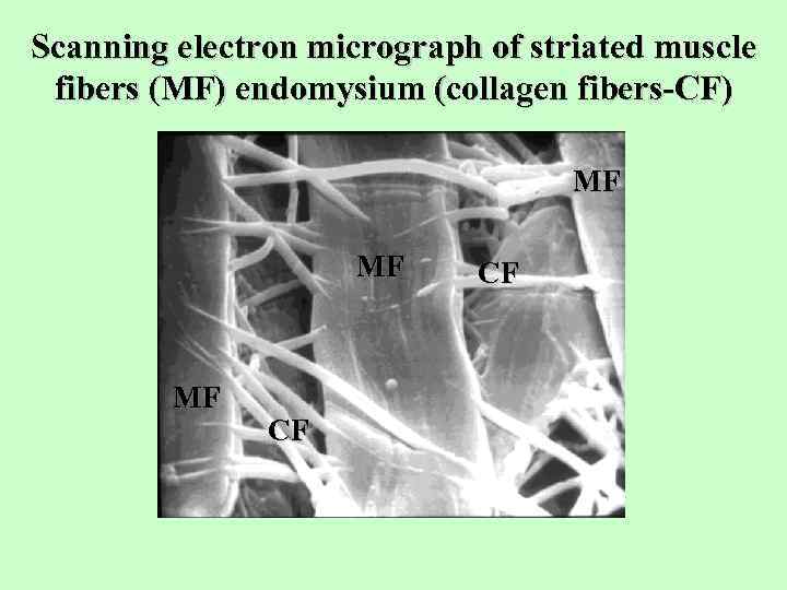 Scanning electron micrograph of striated muscle fibers (MF) endomysium (collagen fibers-СF) MF MF MF