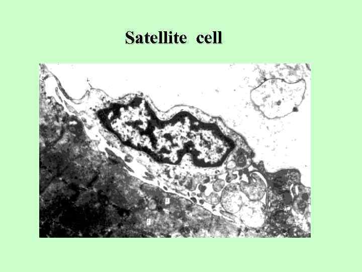 Satellite cell 