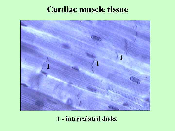 Cardiac muscle tissue 1 1 1 - intercalated disks 1 