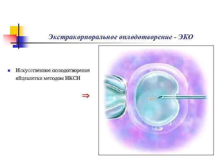 Как происходит искусственное оплодотворение. Искусственное оплодотворение. Эко это искусственное оплодотворение. ИКСИ оплодотворение. ИКСИ оплодотворение показания.