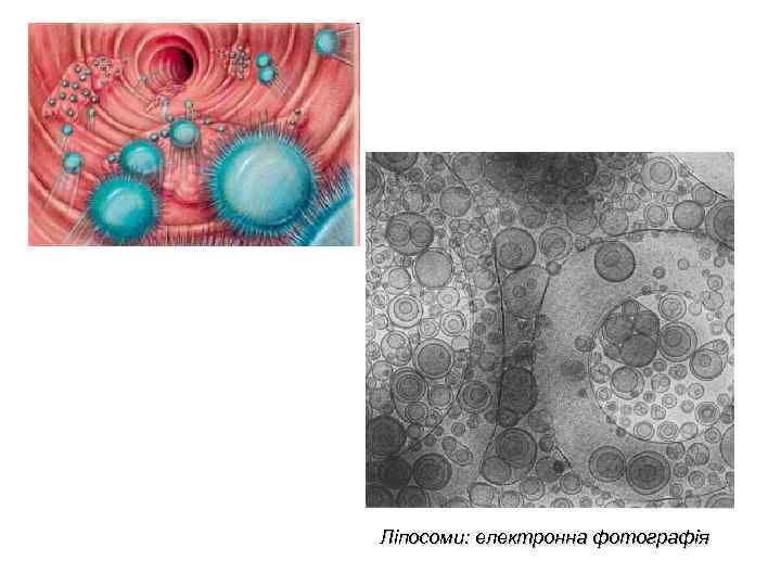 Ліпосоми: електронна фотографія 
