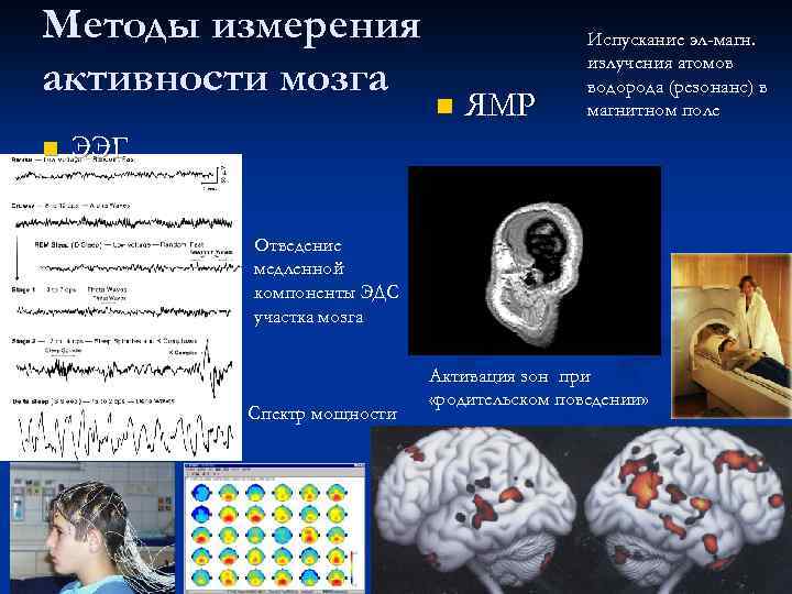 Методы измерения активности мозга n n ЯМР Испускание эл-магн. излучения атомов водорода (резонанс) в