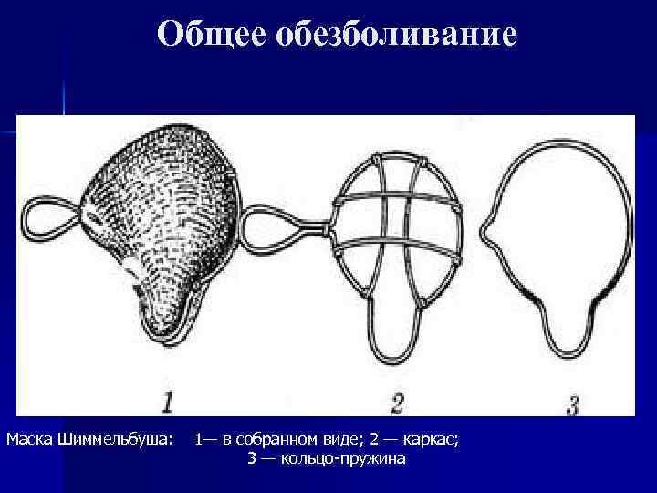 Общее обезболивание Маска Шиммельбуша: 1— в собранном виде; 2 — каркас; 3 — кольцо-пружина