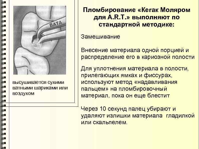 Пломбирование «Кегак Моляром для A. R. T. » выполняют по стандартной методике: Замешивание Внесение