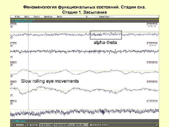 Феноменология функциональных состояний. Стадии сна. Стадия 1. Засыпание 