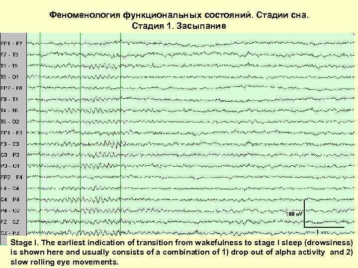 Феноменология функциональных состояний. Стадии сна. Стадия 1. Засыпание Stage I. The earliest indication of