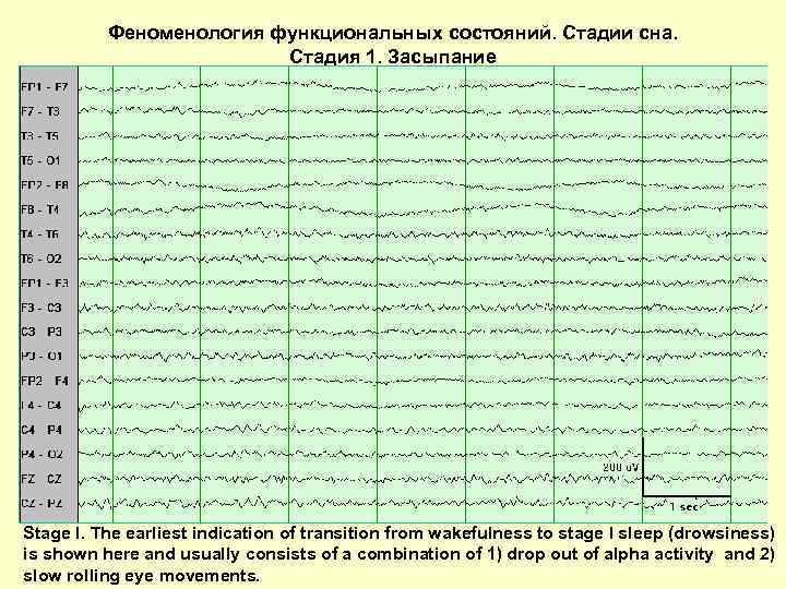 Феноменология функциональных состояний. Стадии сна. Стадия 1. Засыпание Stage I. The earliest indication of