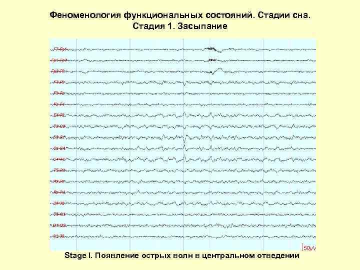 Феноменология функциональных состояний. Стадии сна. Стадия 1. Засыпание Stage I. Появление острых волн в