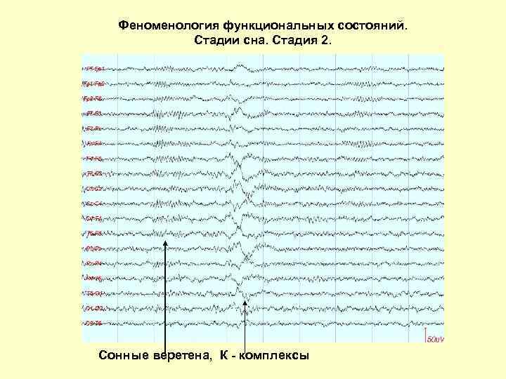 Нарисовать схему стадий сна по данным ээг