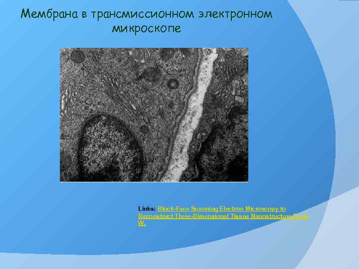 Мембрана в трансмиссионном электронном микроскопе Links: Block-Face Scanning Electron Microscopy to Reconstruct Three-Dimensional Tissue