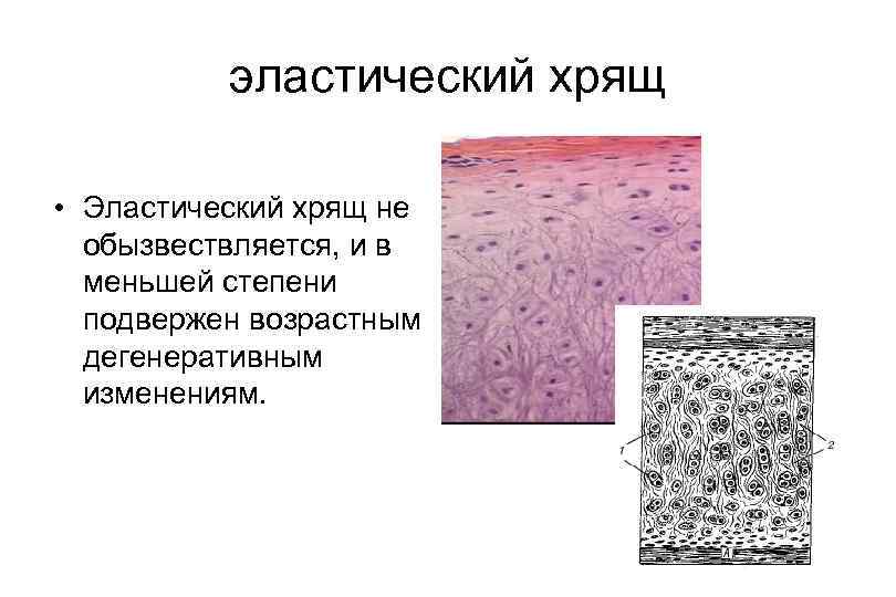 эластический хрящ • Эластический хрящ не обызвествляется, и в меньшей степени подвержен возрастным дегенеративным