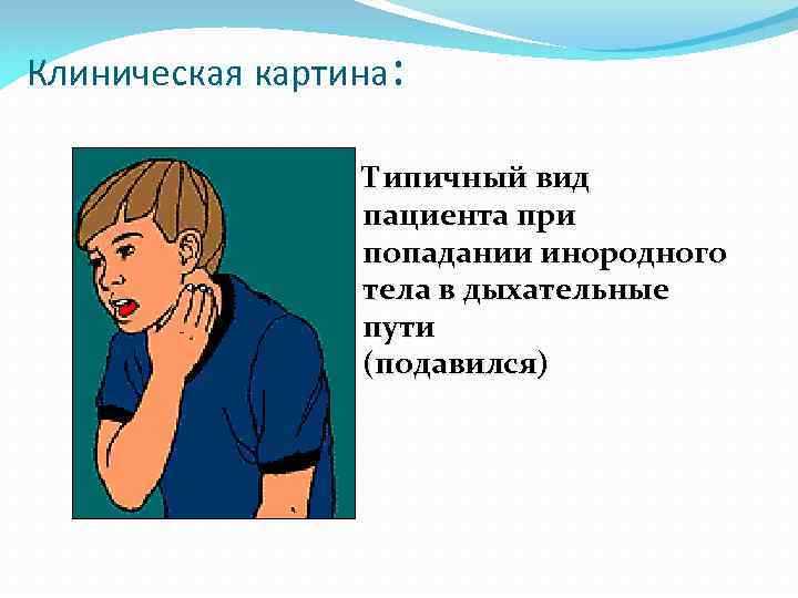 Клиническая картина: Типичный вид пациента при попадании инородного тела в дыхательные пути (подавился) 