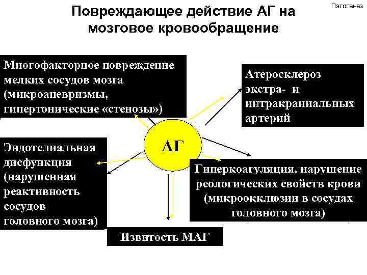 Повреждающее действие АГ на мозговое кровообращение Многофакторное повреждение мелких сосудов мозга (микроаневризмы, гипертонические «стенозы»