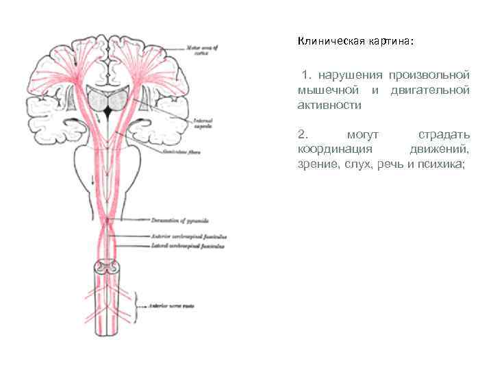 Клиническая картина: 1. нарушения произвольной мышечной и двигательной активности 2. могут страдать координация движений,