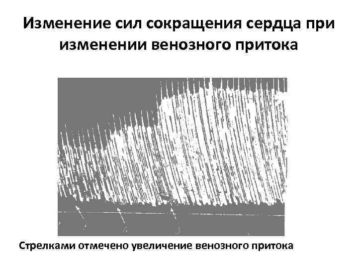 Изменение сил сокращения сердца при изменении венозного притока Стрелками отмечено увеличение венозного притока 