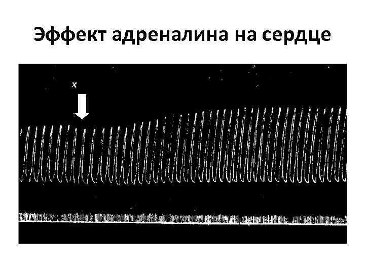 Эффект адреналина на сердце 