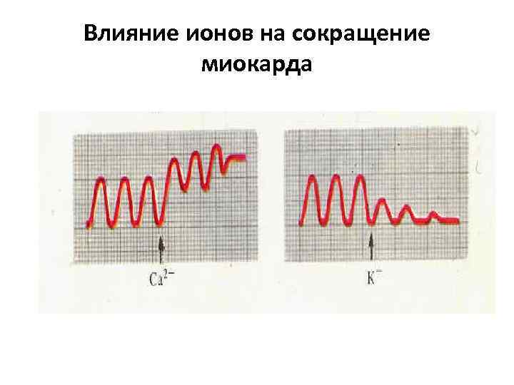 Влияние ионов на сокращение миокарда 