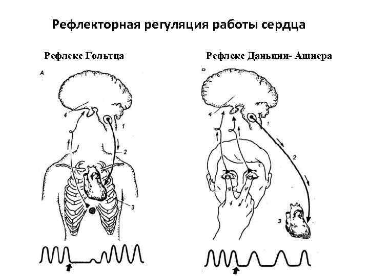 Рефлекторная регуляция работы сердца Рефлекс Гольтца Рефлекс Даньини- Ашнера 
