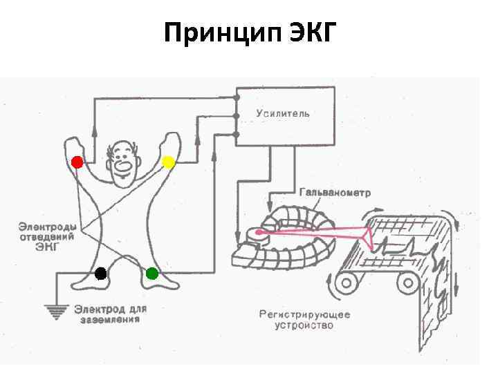 Принцип ЭКГ 