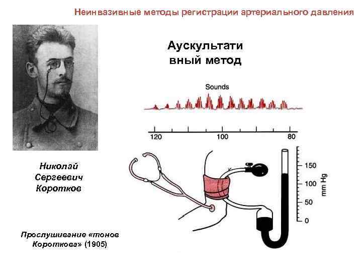 Неинвазивные методы регистрации артериального давления Аускультати вный метод Николай Сергеевич Коротков Прослушивание «тонов Короткова»