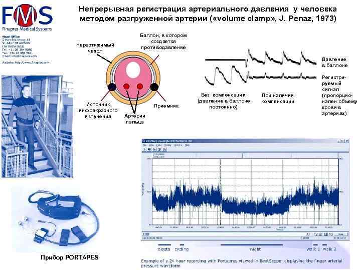 Непрерывная регистрация артериального давления у человека методом разгруженной артерии ( «volume clamp» , J.