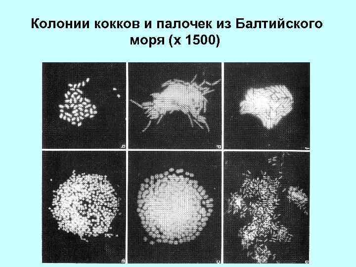  Колонии кокков и палочек из Балтийского моря (х 1500) 