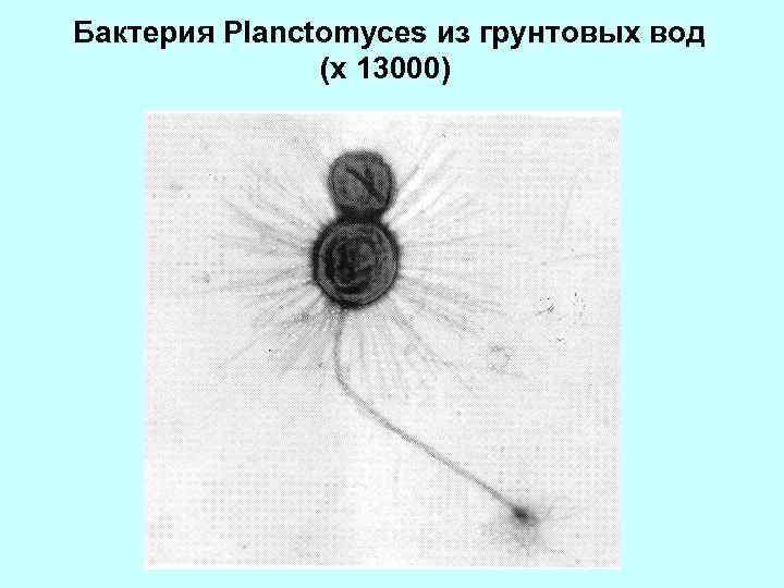  Бактерия Planctomyces из грунтовых вод (х 13000) 