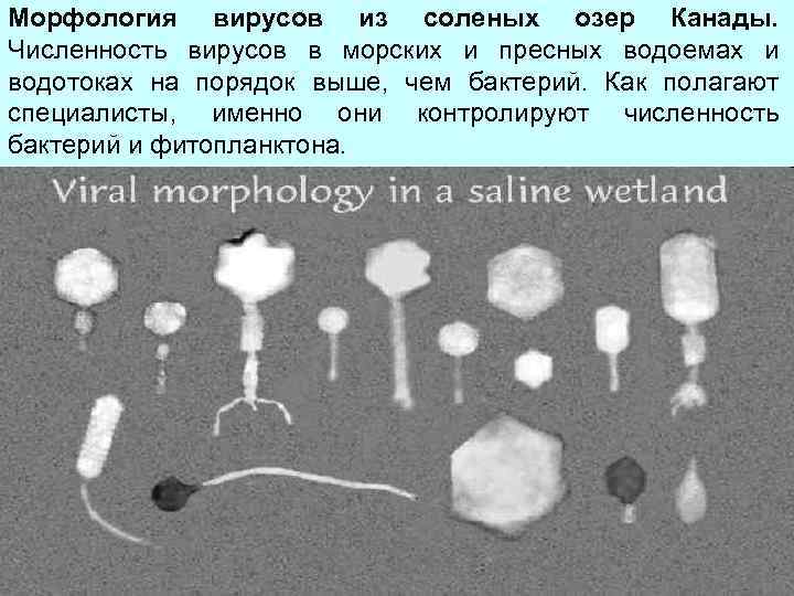 Морфология вирусов из соленых озер Канады. Численность вирусов в морских и пресных водоемах и