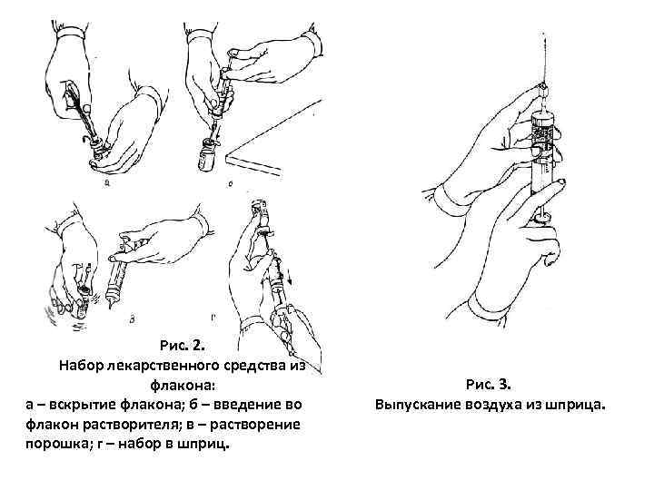 Рис. 2. Набор лекарственного средства из флакона: а – вскрытие флакона; б – введение