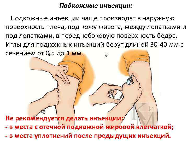 Подкожные инъекции: Подкожные инъекции чаще производят в наружную поверхность плеча, под кожу живота, между