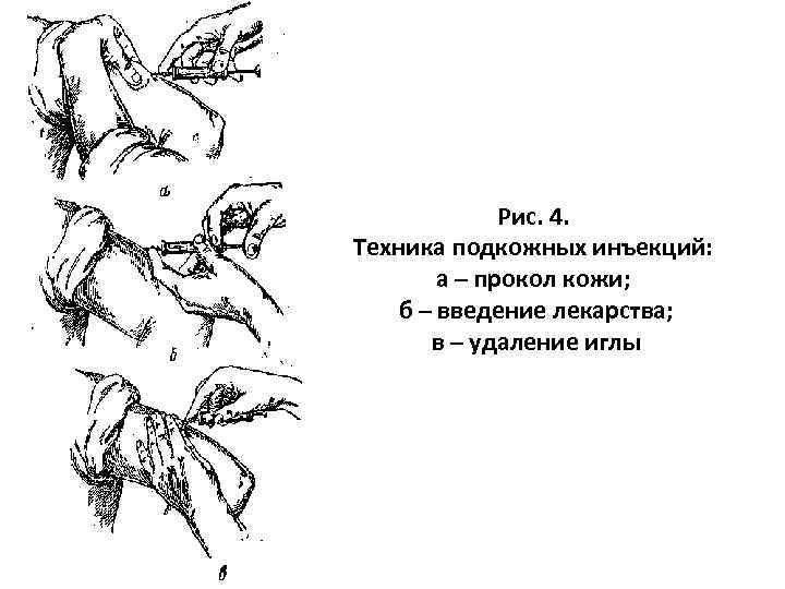  Рис. 4. Техника подкожных инъекций: а – прокол кожи; б – введение лекарства;