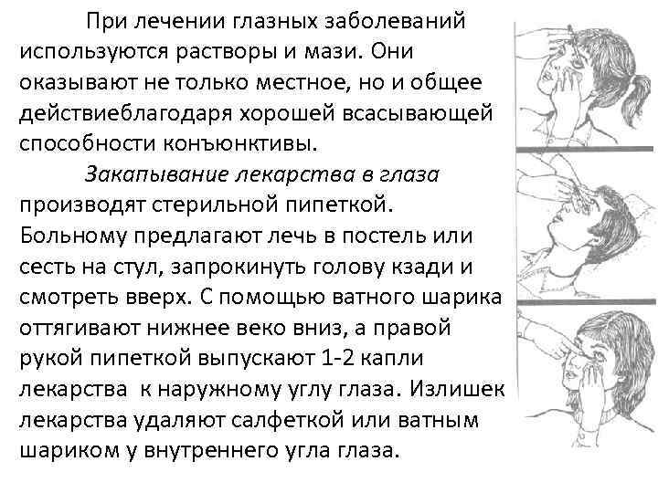 При лечении глазных заболеваний используются растворы и мази. Они оказывают не только местное, но