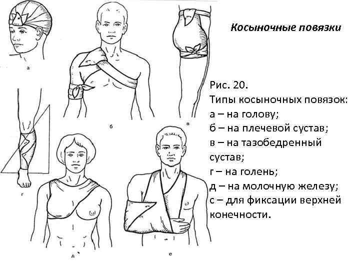 Косыночная повязка схема