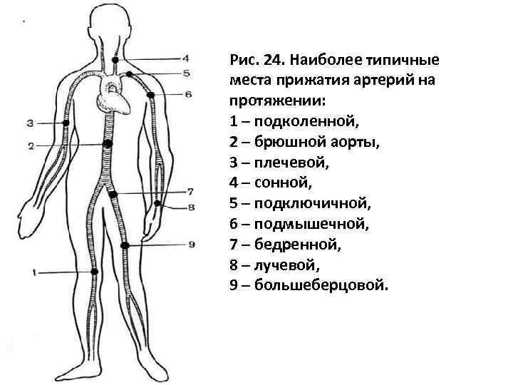 Сопоставьте изображения точек прижатия артерий с наименованиями артерий