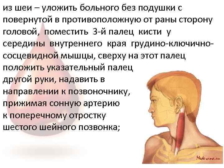 из шеи – уложить больного без подушки с повернутой в противоположную от раны сторону