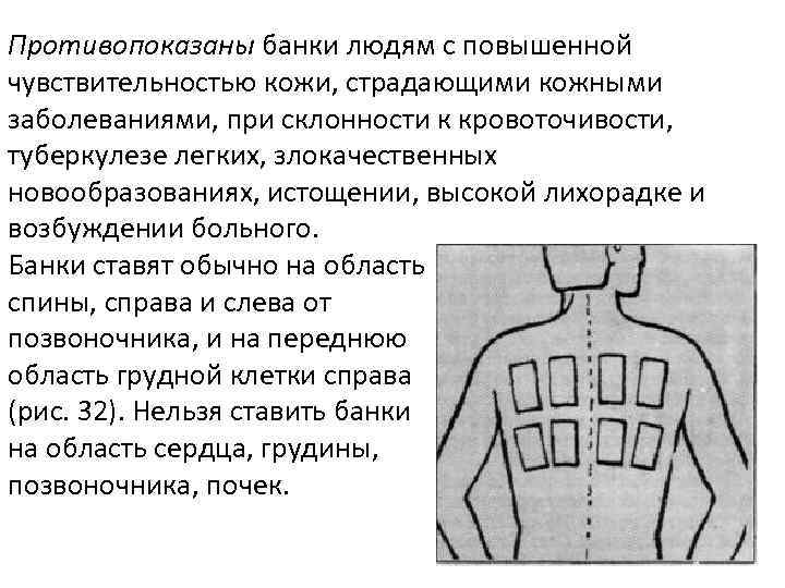 Противопоказаны банки людям с повышенной чувствительностью кожи, страдающими кожными заболеваниями, при склонности к кровоточивости,