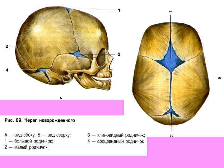 Типы родничков. Швы черепа вид сбоку. Роднички новорожденного анатомия черепа. Швы и роднички черепа анатомия. Швы костей черепа.